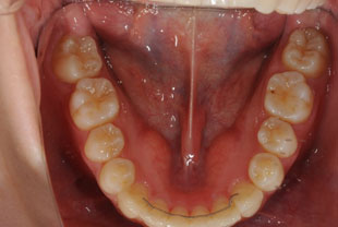 %ef%bc%97%e5%9f%8b%e4%bc%8f%e6%95%b4%e7%9b%b4%e5%be%8c%e3%80%80%e5%8f%a3%e5%86%99%e7%9c%9f